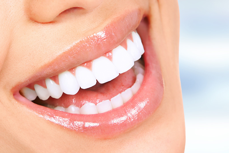 Teeth Whitening in Palmdale