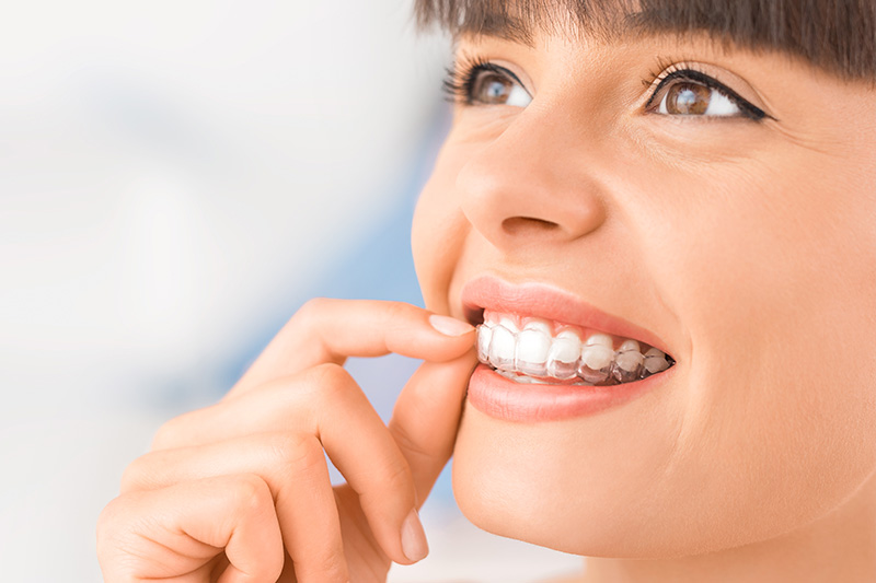 Invisalign in Palmdale